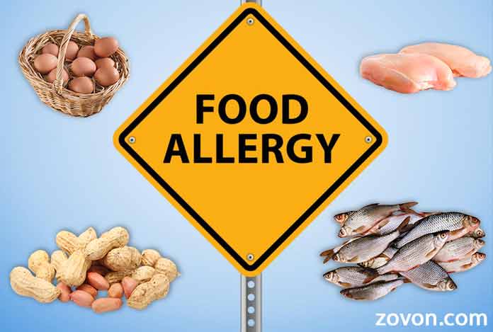Genes-responsible-for-peanut-allergies,-study-suggests image
