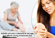 Arthritis not only a disease of old age, but affects young Americans too arthritis not only a disease of old age but affects young americans too