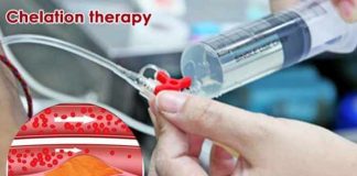 Chelation Therapy- how and when? chelation therapy how and when