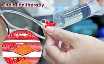 chelation therapy how and when