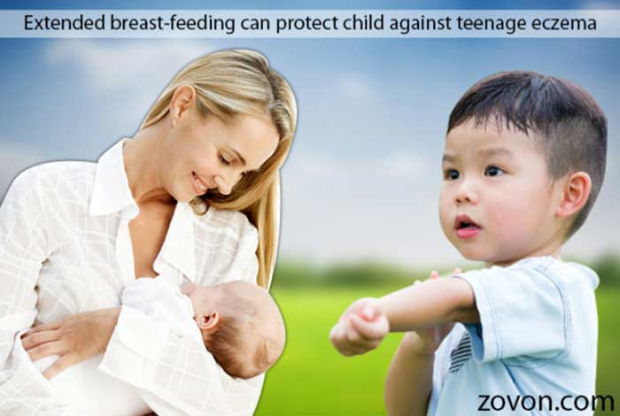 Extended breast-feeding can protect child against teenage eczema extended breast feeding can protect child against teenage eczema
