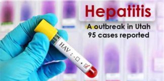 Hepatitis A outbreak in Utah; 95 cases reported hepatitis a outbreak in utah 95 cases reported
