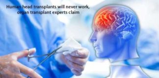 Human head transplants will never work, organ transplant experts claim human head transplants will never work organ transplant experts claim