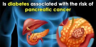 is diabetes associated with the risk of pancreatic cancer