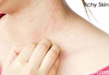 Itchy skin: Symptoms, causes and treatment itchy skin symptoms causes and treatment