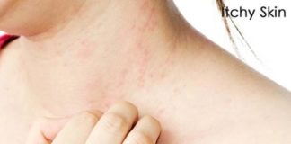 itchy skin symptoms causes and treatment