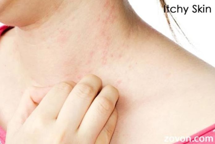 itchy skin symptoms causes and treatment