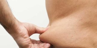 liposuction may reduce lymphedema in cancer patients