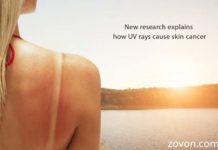 New research explains how UV rays cause skin cancer new research explains how uv rays cause skin cancer