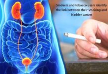 smokers and tobacco users identify the link between their smoking and bladder cancer