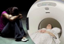 study says structural changes in brain similar in people with depression and anxiety