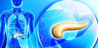 Pancreatic Cancer Overview and statistical facts
