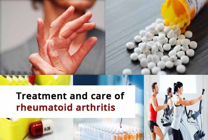 rheumatoid arthritis Treatment and Care