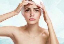 13 essential home remedies for acne