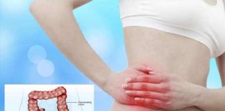 appendicitis types symptoms causes prevention and treatment