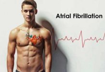 Atrial Fibrillation – Symptoms, Causes, Prevention and Treatment atrial fibrillation symptoms causes prevention and treatment