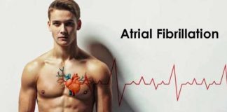 atrial fibrillation symptoms causes prevention and treatment