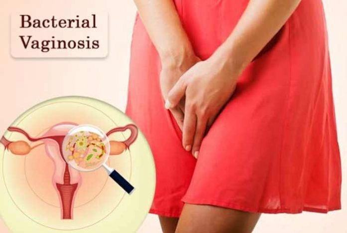 bacterial vaginosis treatment along with symptoms types and prevention methods