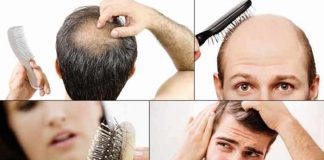 baldness symptoms causes pattern prevention and treatment