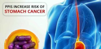 ppis increase risk of stomach cancer