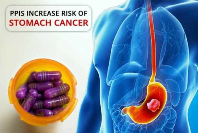 ppis increase risk of stomach cancer