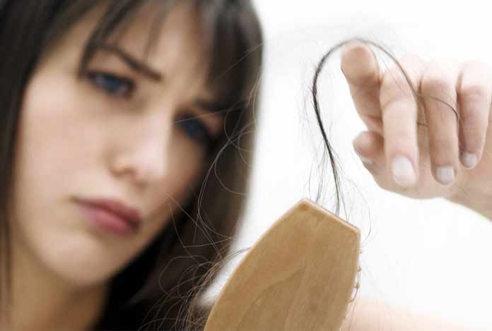 2. Hair Fall – What Role does Dandruff Play in It? 