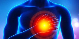 Angina