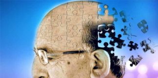 Alzheimer’s Disease and Myths About it