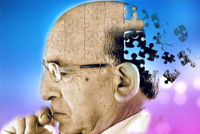 Alzheimer’s Disease and Myths About it