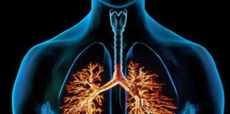 Bronchitis