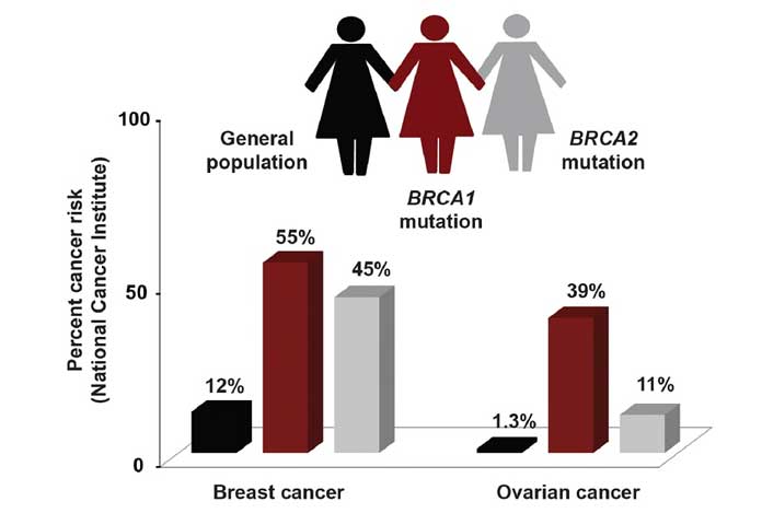 Causes of Breast Cancer