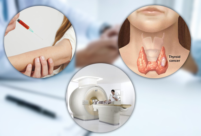 Diagnosis and Test of Hyperthyroidism