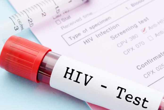 Diagnosis and Tests of HIV