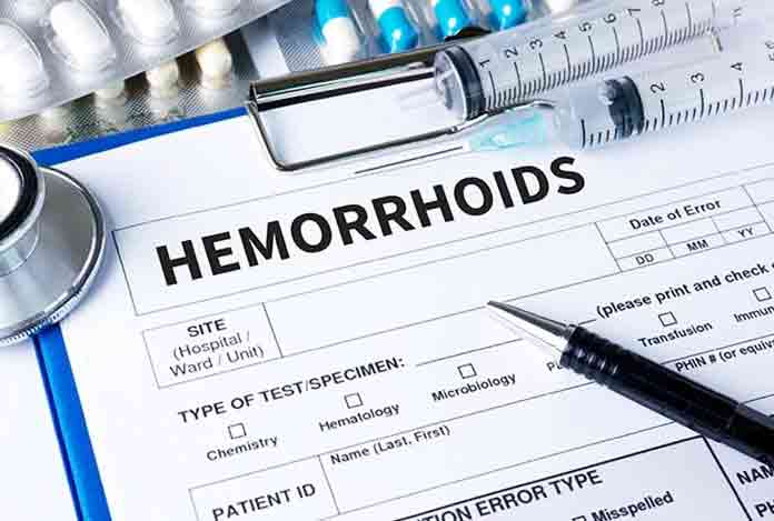 Diagnosis of Hemorrhoids