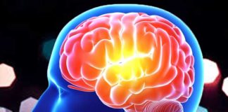 Encephalitis
