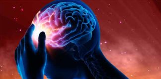 Epilepsy