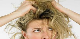 Hair Fall – What Role does Dandruff Play in It?