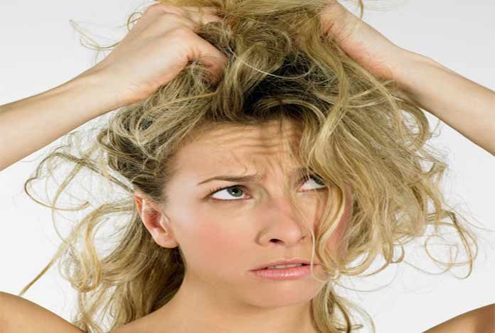 Hair Fall – What Role does Dandruff Play in It?