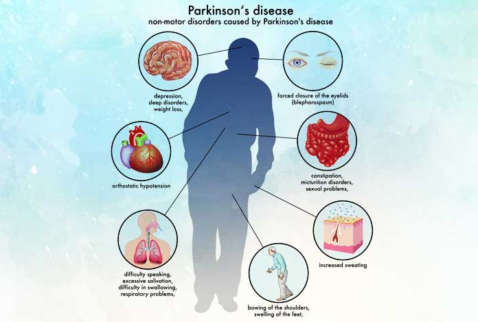 Stages for Parkinson's Disease