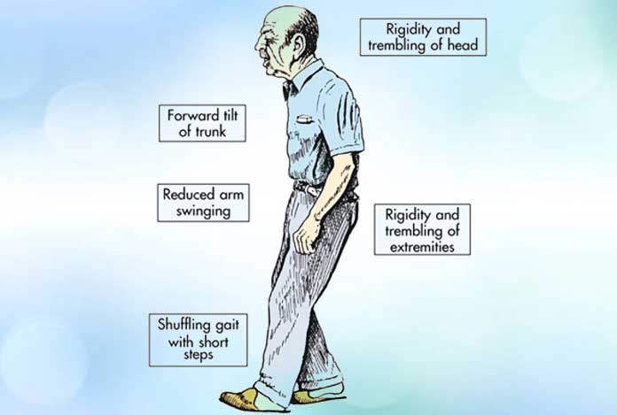 Types and Symptoms for Parkinson's Disease