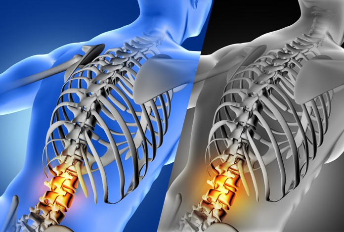 Types and Symptoms of Psoriatic Arthritis