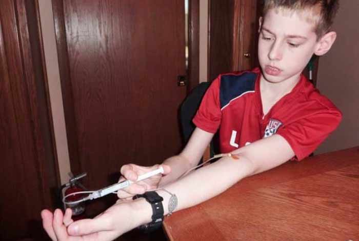 caring during hemophilia