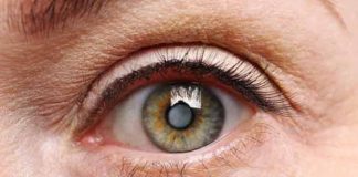 cataracts types symptoms causes prevention and treatment