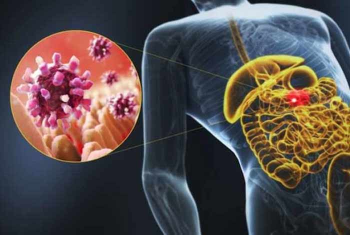 causes of lactose intolerance