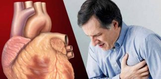 coronary artery disease types symptoms causes risk factors and treatment
