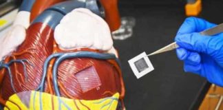 large heart muscle patches from human heart cells improve recovery from heart attack