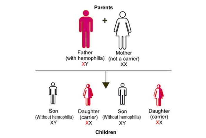 risk factors for hemophilia