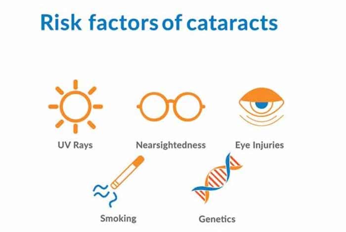 risk factors of cataract