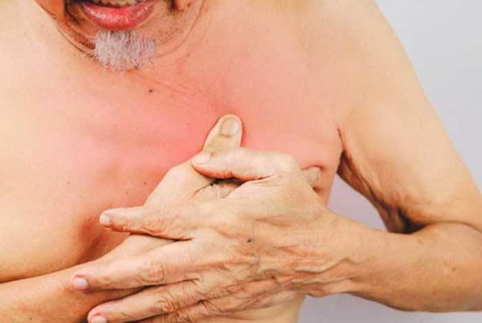 symptoms of breast cancer in men