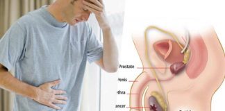 testicular cancer causes symptoms tests and treatment